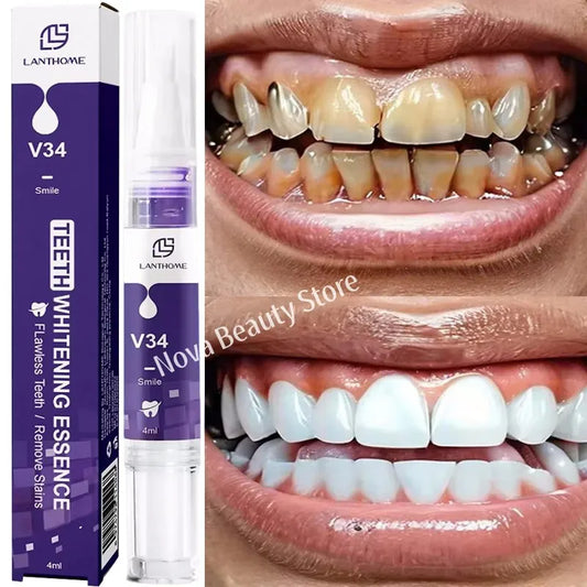 Stylo de blanchiment des dents magiques